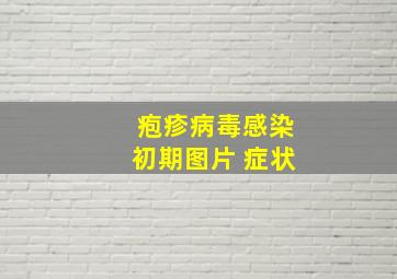 疱疹病毒感染初期图片 症状